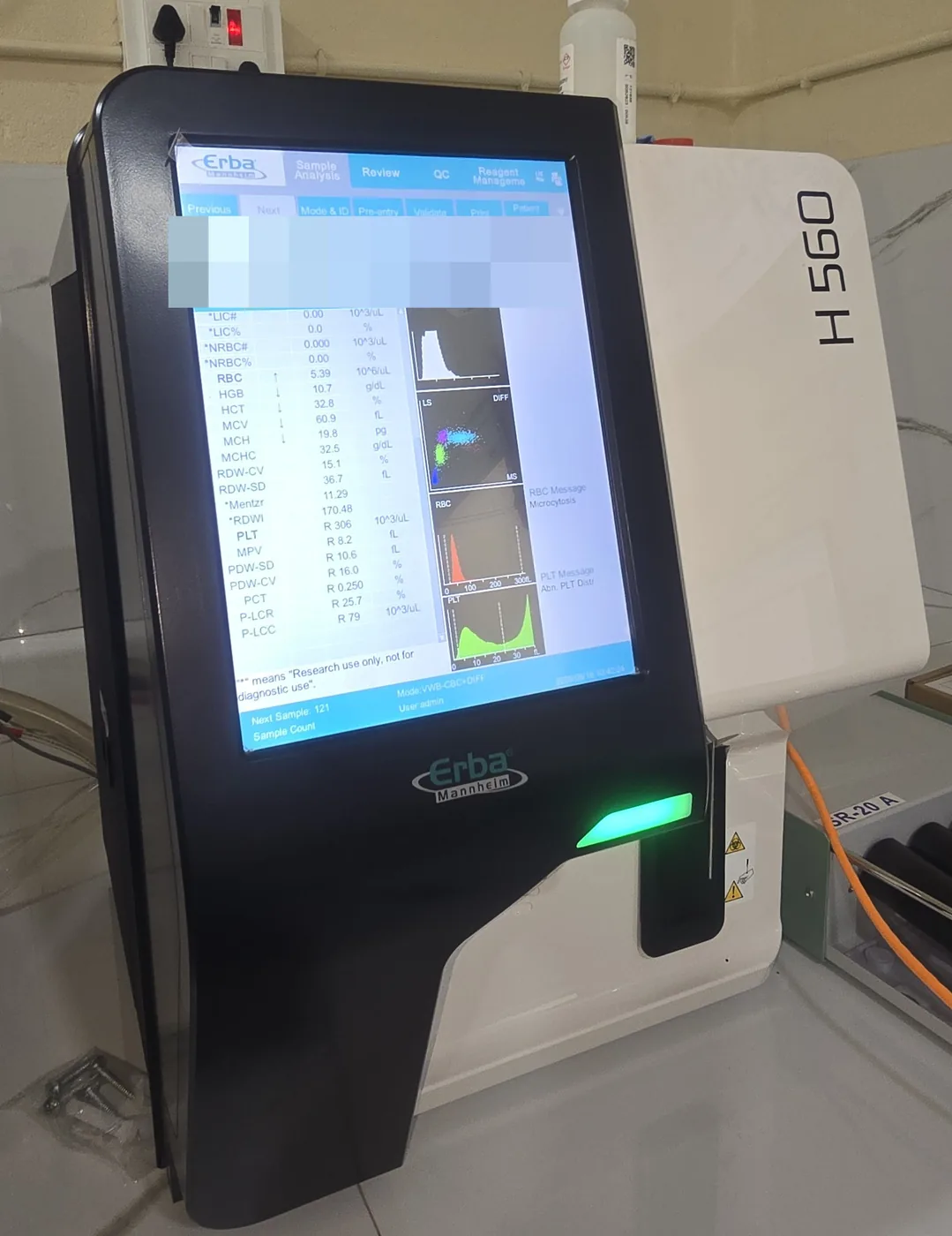 The Erba H 560 haematology analyser mid-run, a blood count on its screen