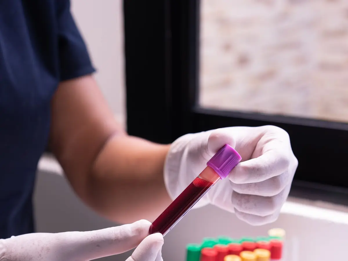 A sealed blood collection tube handled in gloves, beside a rack of vacutainers